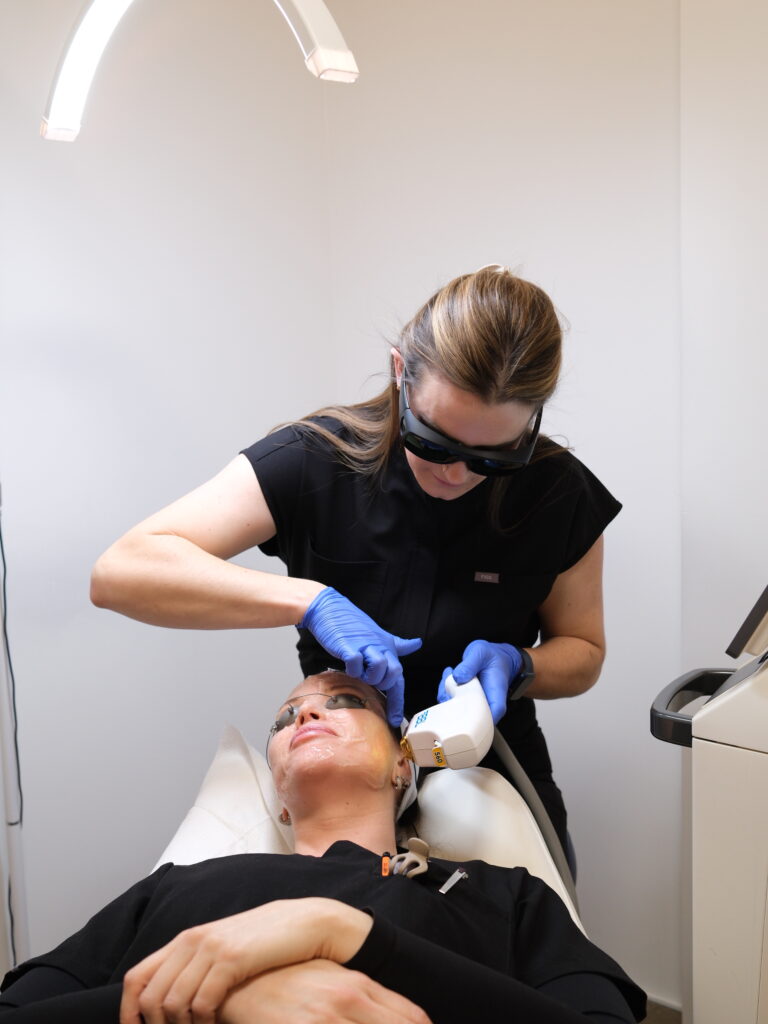 BBL Treatment at True Aesthetics YEG