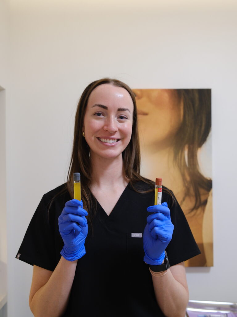 Platelet Rich Plasma Therapy at True Aesthetics YEG